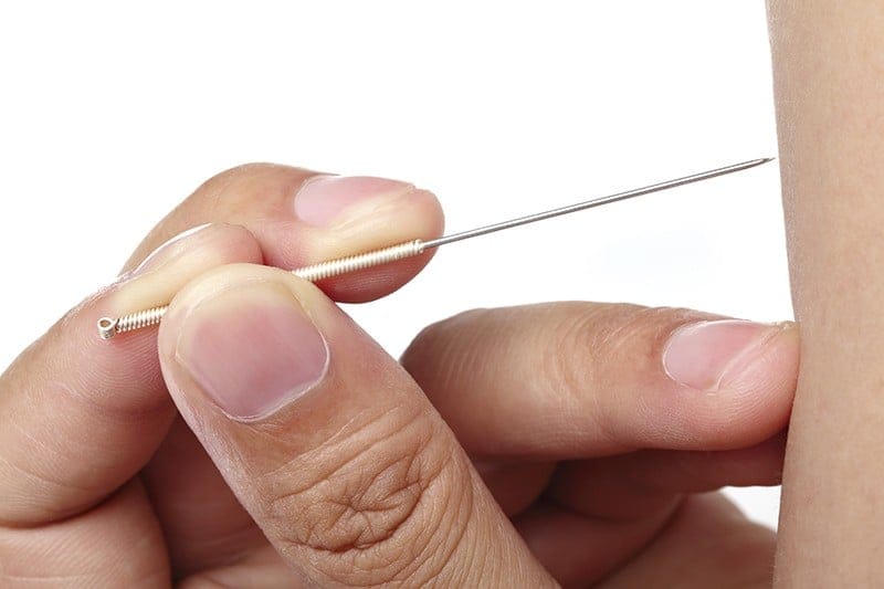 Bliv RAB-godkendt Akupunktør i Viborg