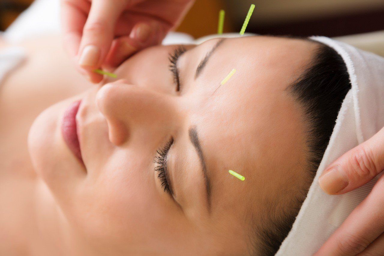 Kursus Kosmetisk Akupunktur